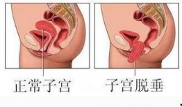 子宫在线观看,在线探索女性生殖奥秘之旅