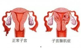 子宫在线观看,在线探索女性生殖奥秘之旅